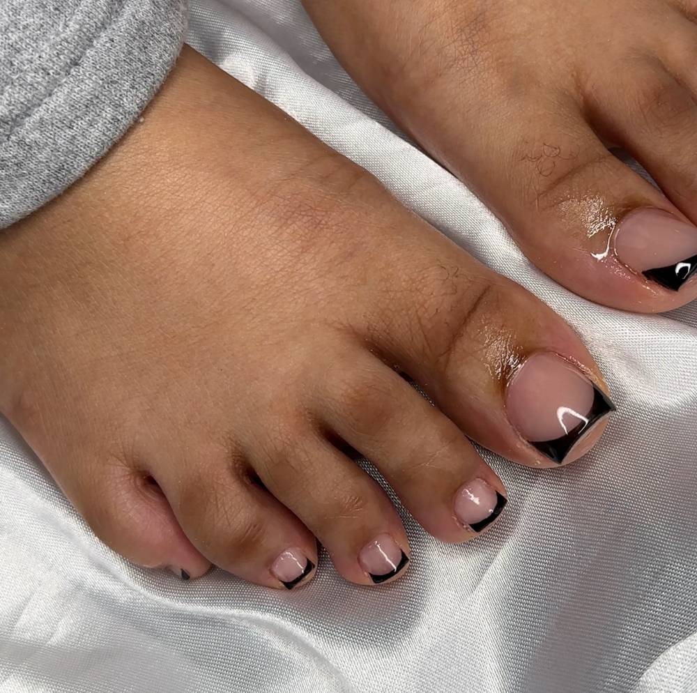 Acrylic Toe Reconstuction
