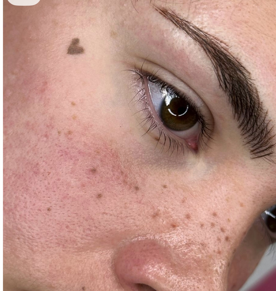 Permanent Beauty Mark at Touched By TK in Charlotte, NC
