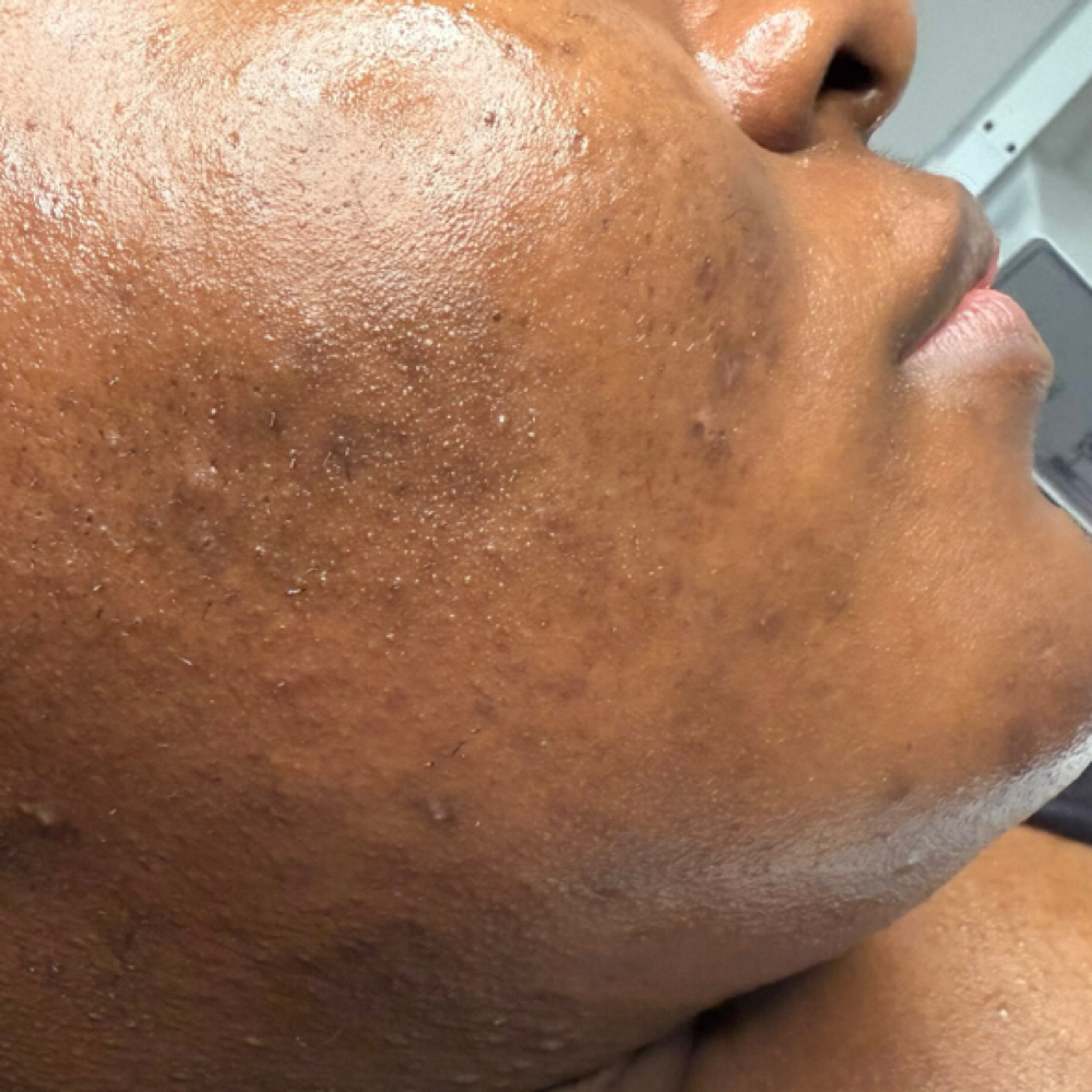 Full Face Wax at Sapphire Skin Studio in Broken Arrow, OK