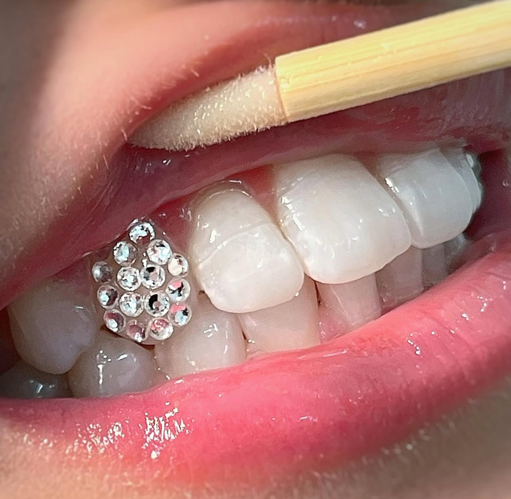 Disco ( Full Tooth )