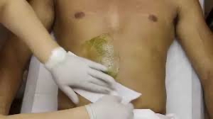 Stomach Strip