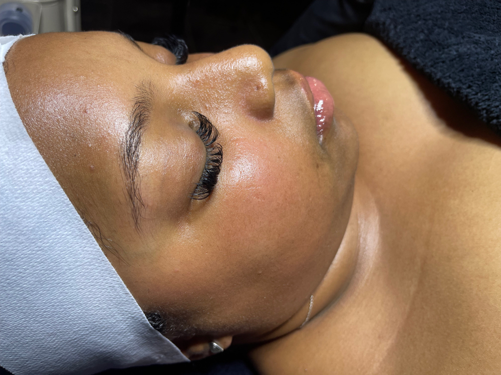 Radiance Renewal Facial