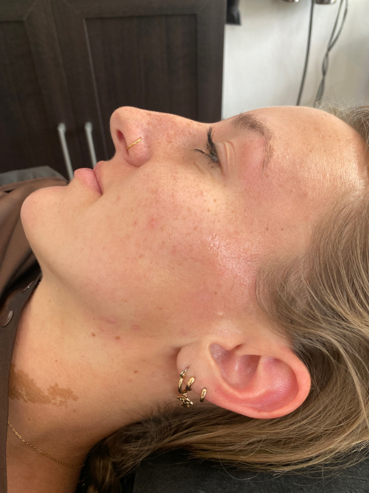 Sides of Face Wax