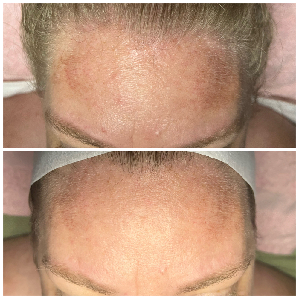 Pro Bright at Natural Beauty Esthetics in Tyler, TX