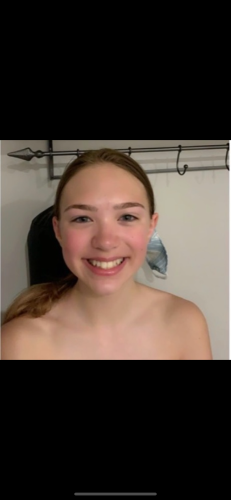 Teen Facial