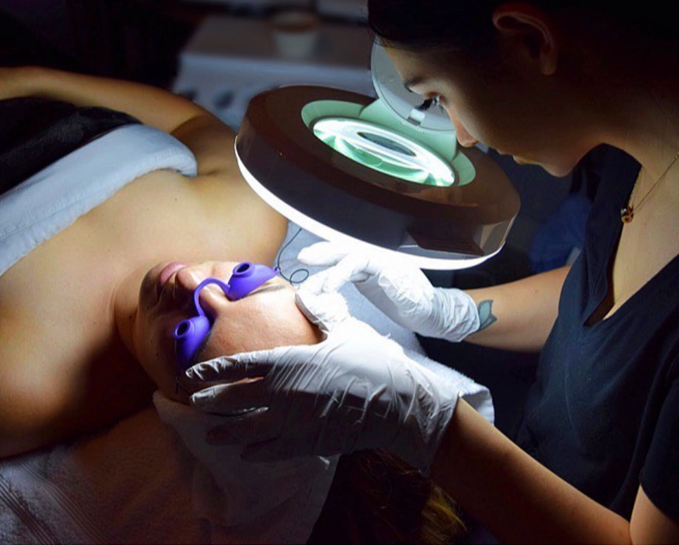 Acne Consultation