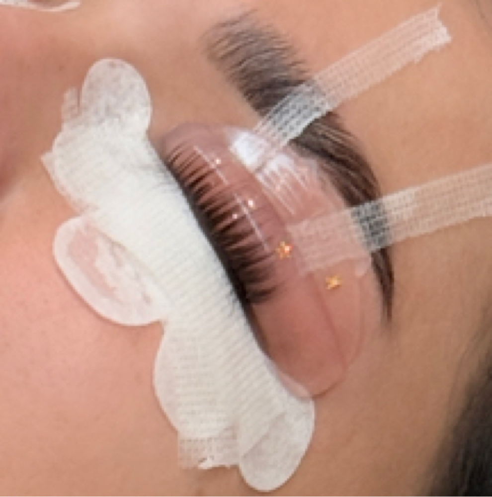 Eyelash Lift at MicroBaddie Co. in Chicago, IL