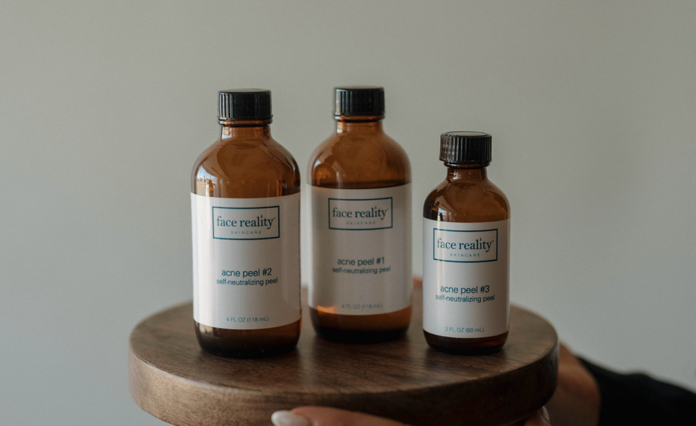 Chemical Peel