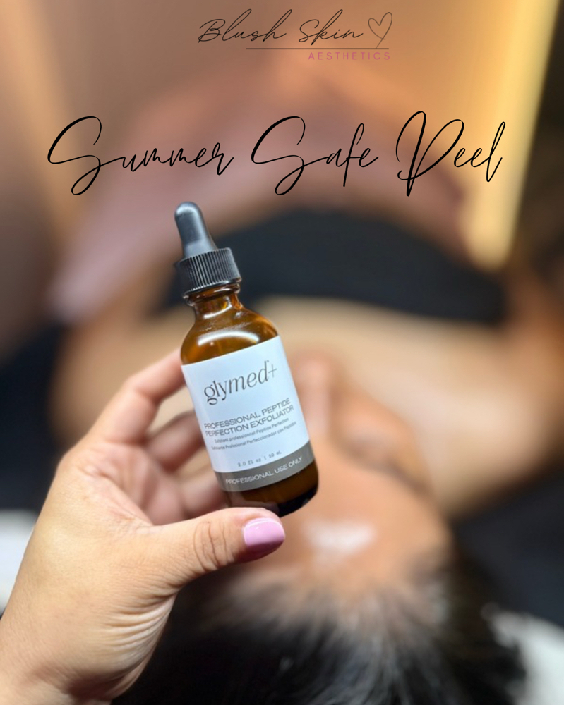Summer Safe Chemical Peel