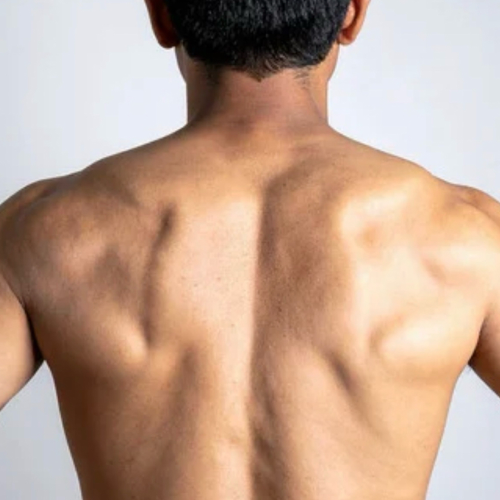 Back wax at Becca Davis Aesthetics in Friendswood, TX