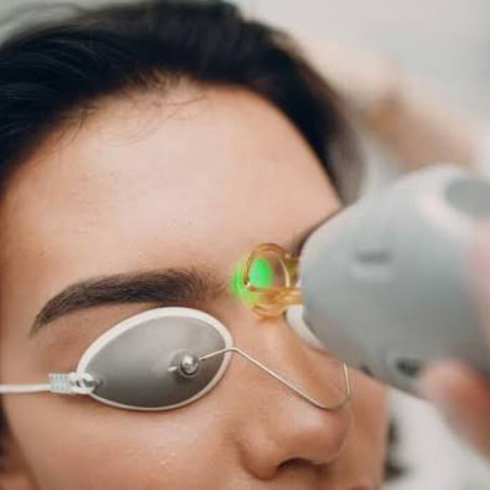 LaserHairRemoval In Between EyeBrow at All Aesthetics Kare in Upland, CA