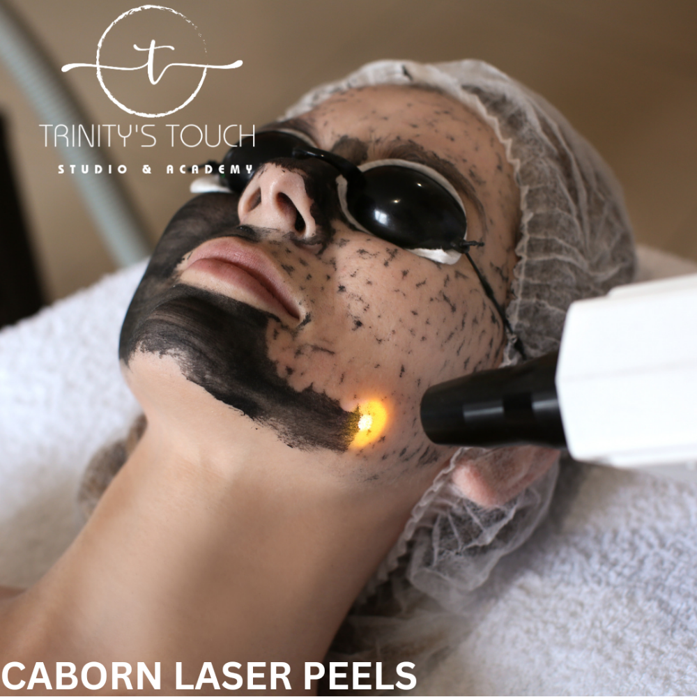 CABORN LASER PEELS