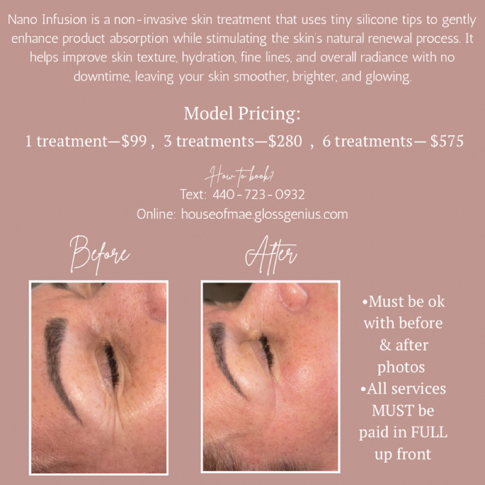 Nano Infusion Model 3 Treatments at House of Mae Madilyn Anney Esthetics in Amherst, OH