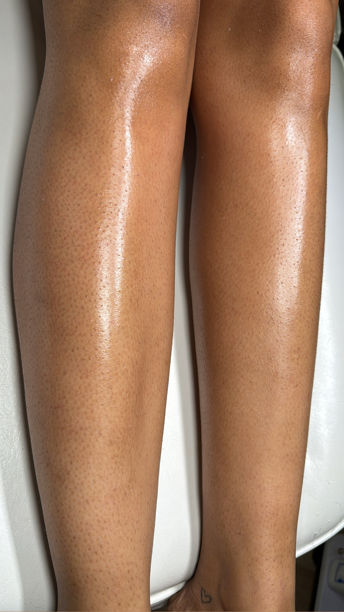Lower Legs