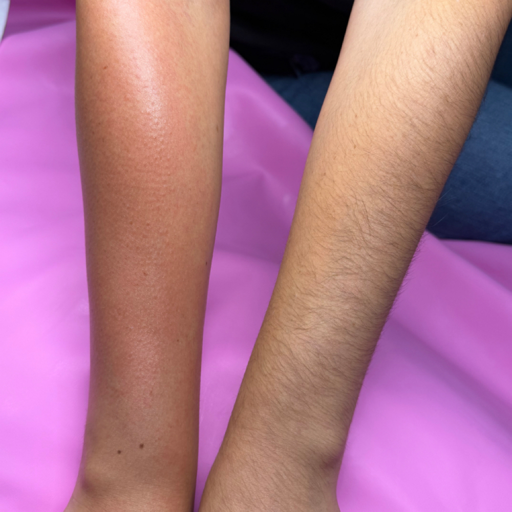 Half Arm Wax at Mel Esthetics LLC in Denver City, TX
