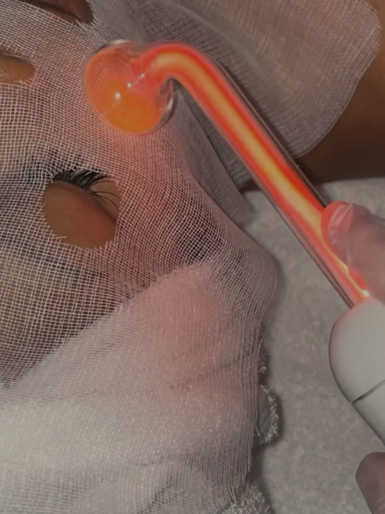 High Frequency - Face + Acne at The Twisted Angel Salon & Spa in Bloomington, IN