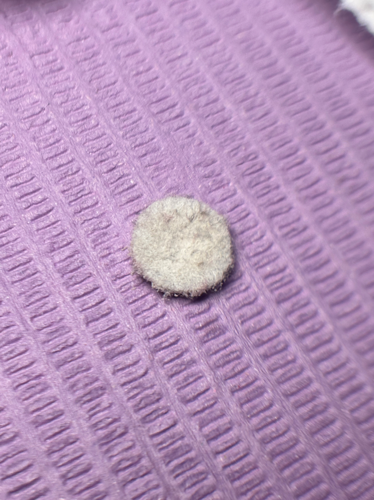 Microdemabrassion Facial