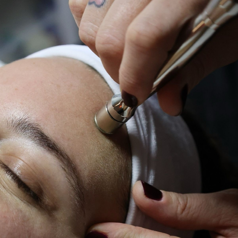 Microdemabrassion Facial at Alejos Aesthetics in Cleveland, TX