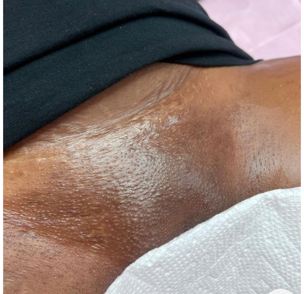 Brazilian Wax
