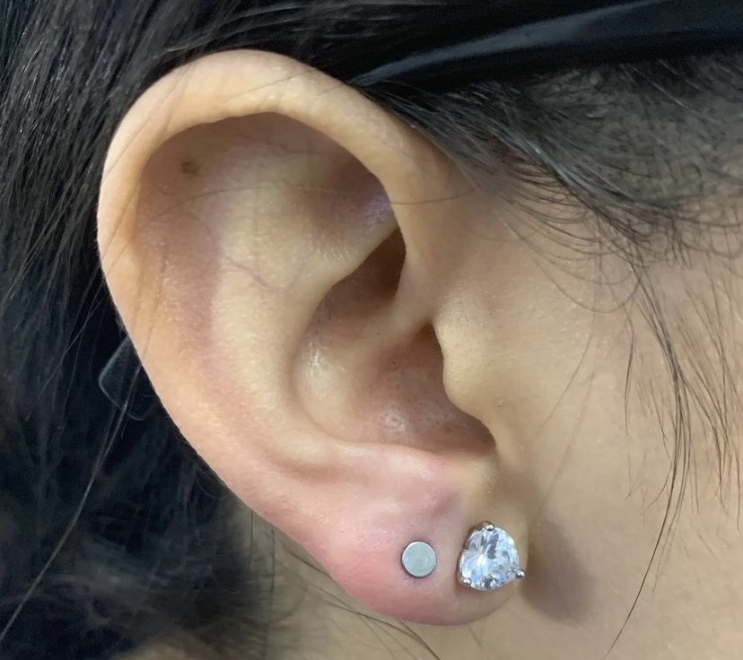Lobes (pair)