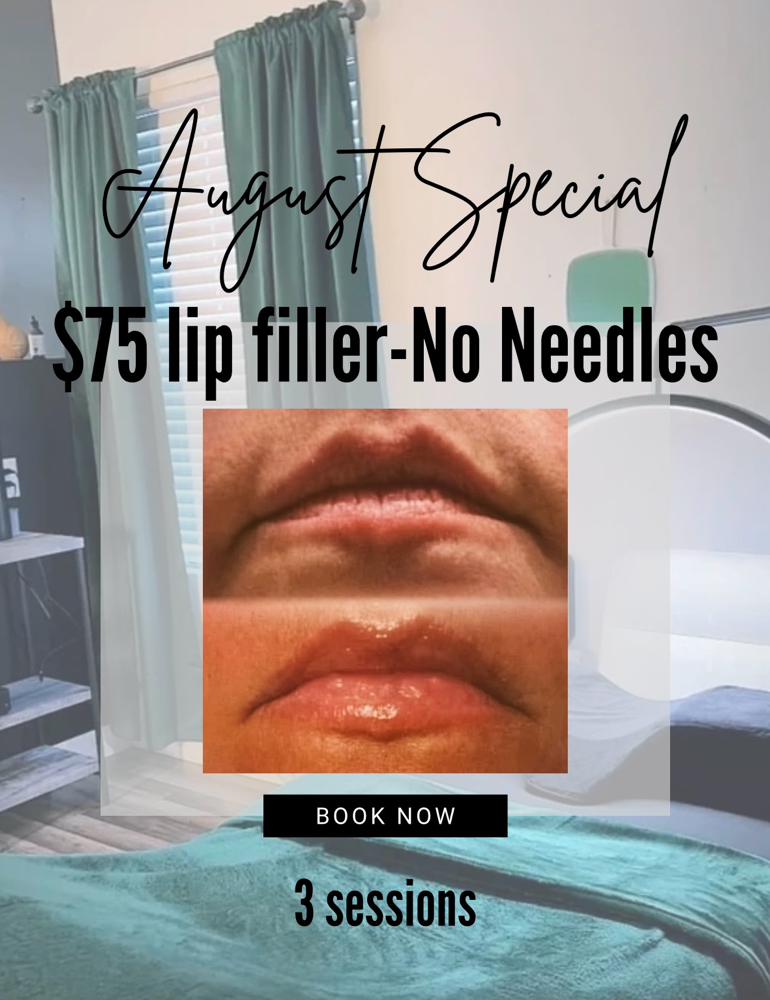 Lip Enhancement - No Needles