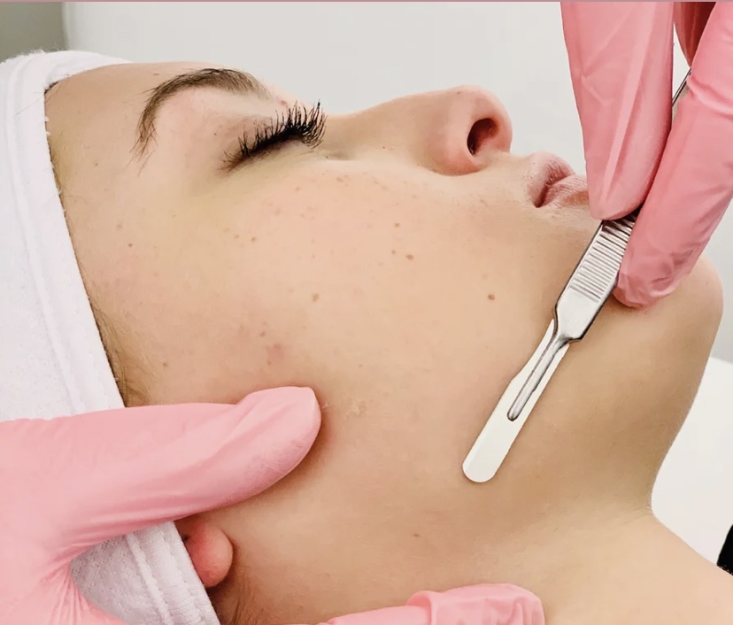 Dermaplaning