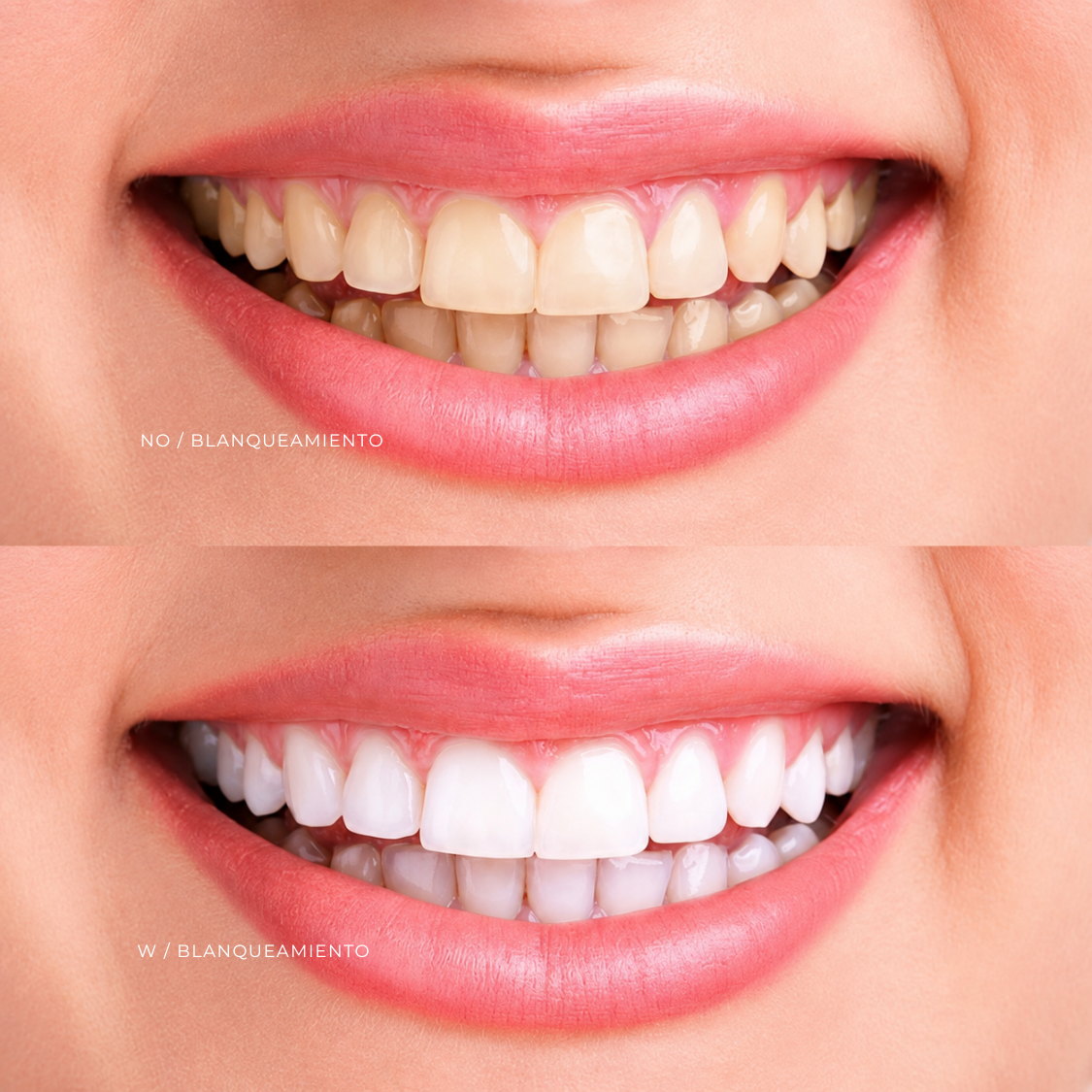 BLANQUEAMIENTO DENTAL at EROXSPA in Houston, TX