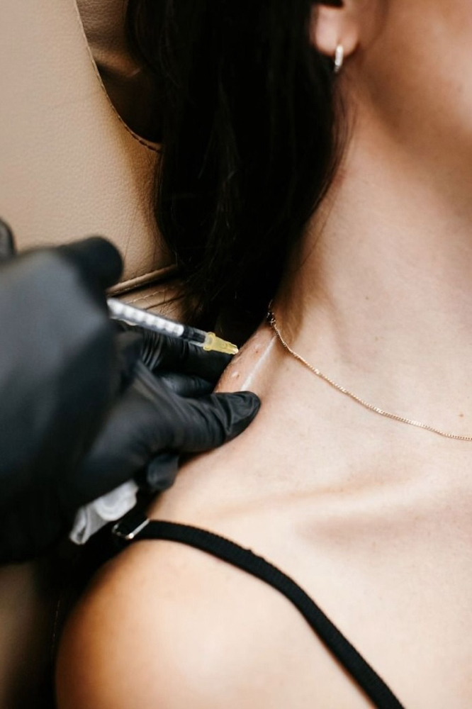 Trapezius Tox