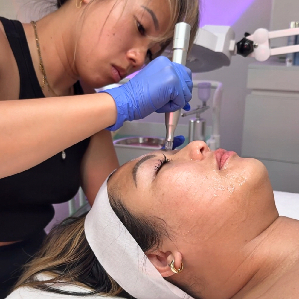 Nano Infusion Add On at ✨ Luminary Glow ✨ | Pasadena, CA in Pasadena, CA