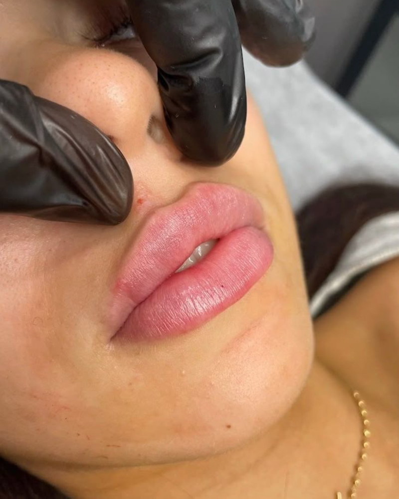 Lip Flip