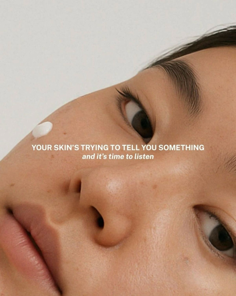 Skin Analysis