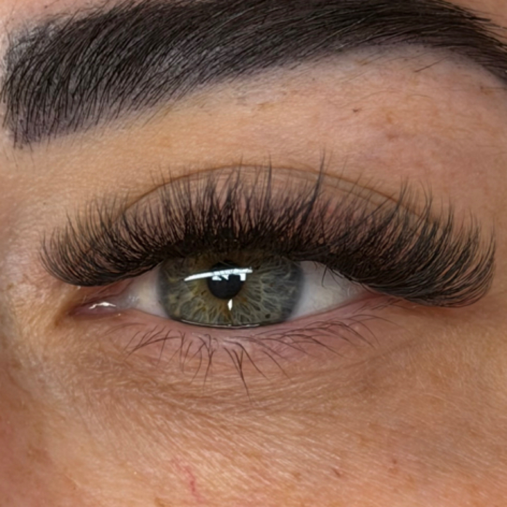 Volume Fill at Esthetics by Eden in Willits, CA