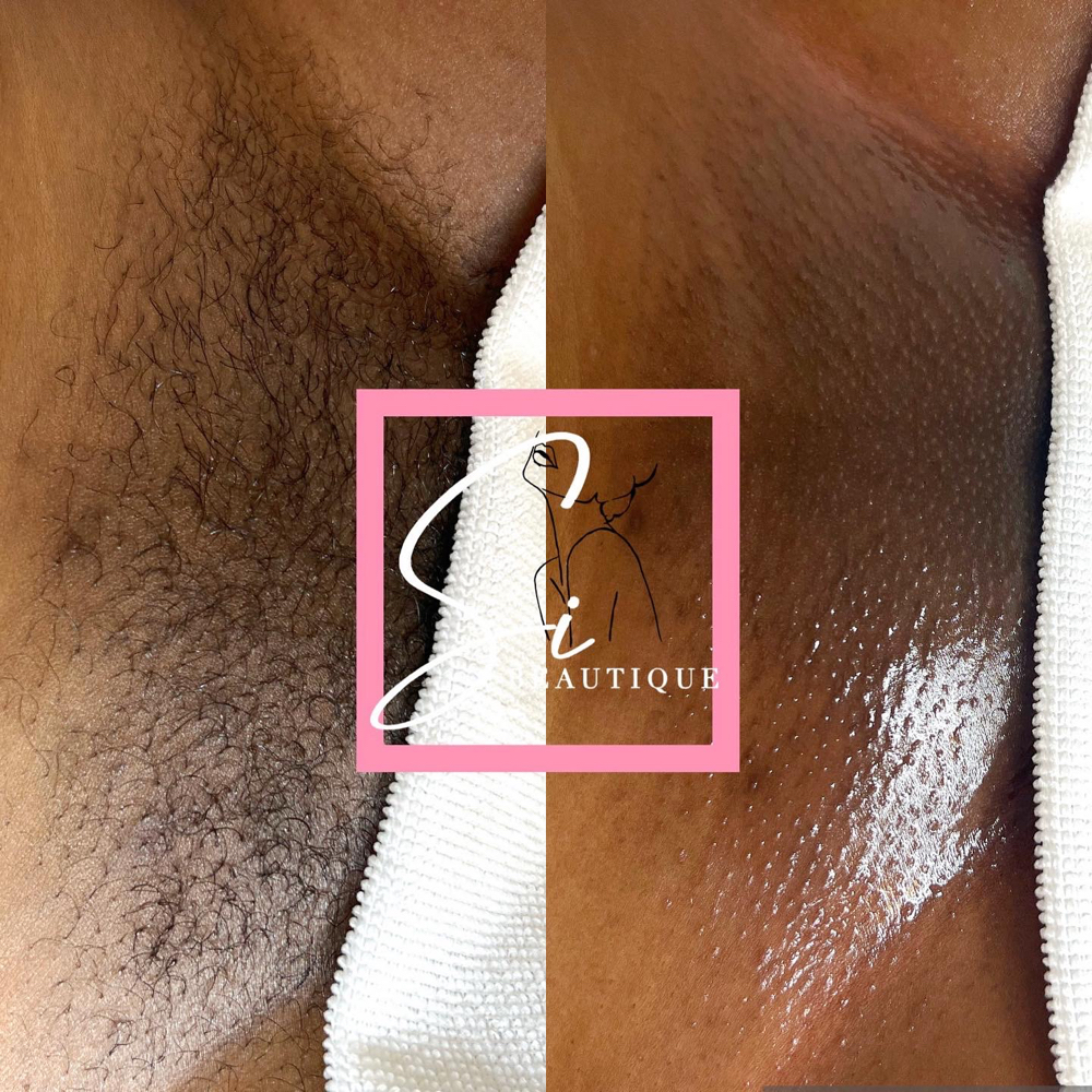 Brazilian Wax