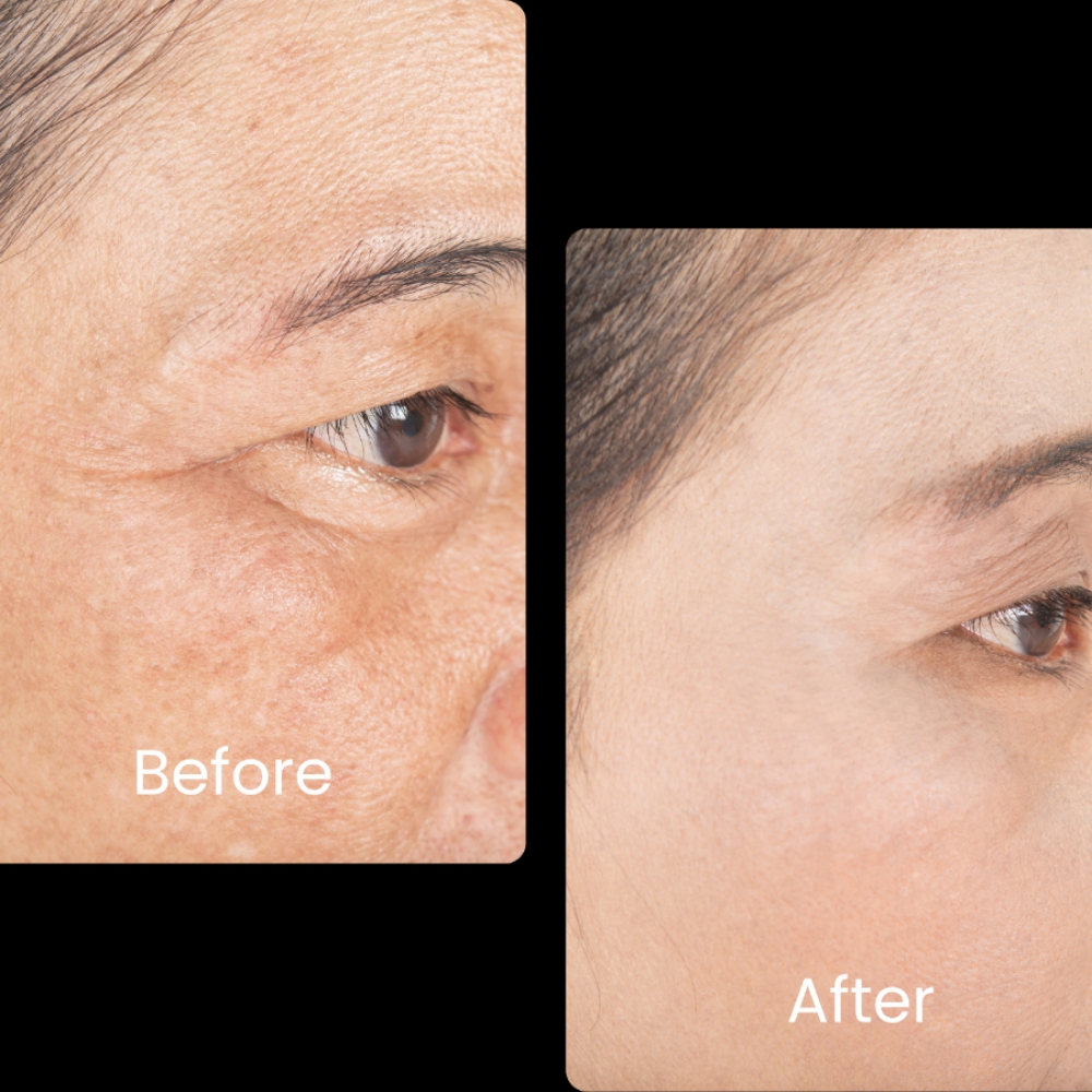 Anti Aging GHK-Cu Peptide Injecti