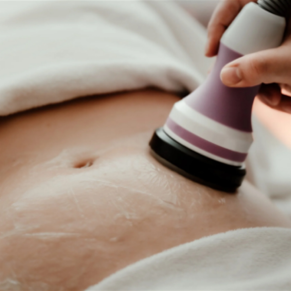 Body Contouring Medium Area at K.Xsthetics in Lavon, TX