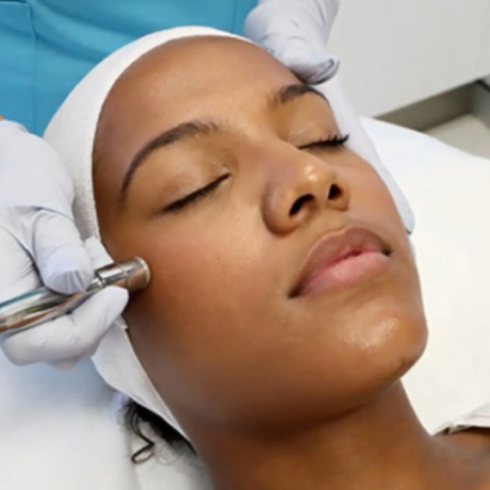 Microdermabrasion With Facial at DermaLuna Lux in West Palm Beach, FL