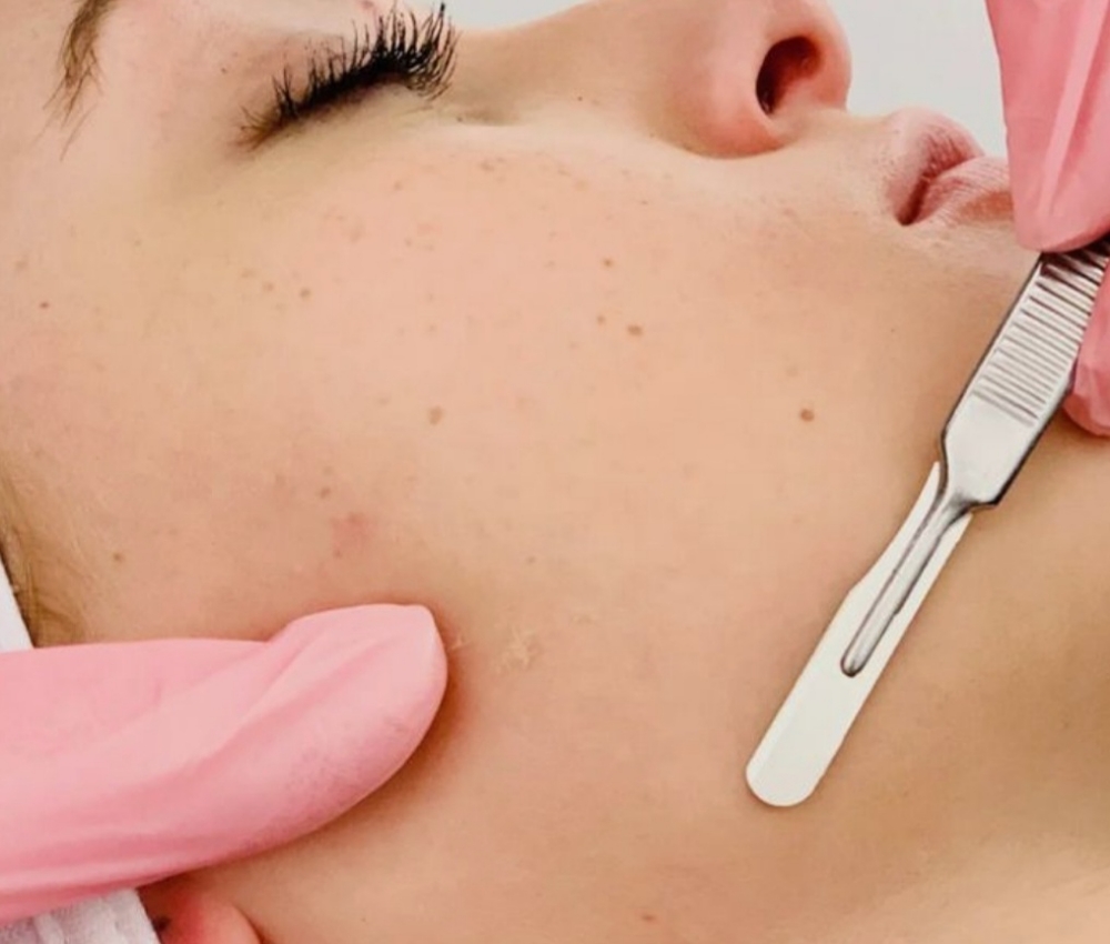 Express Dermaplane 🤍