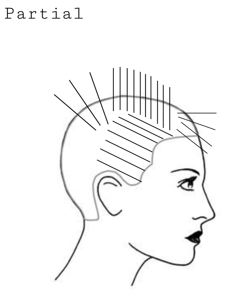 Highlights Partial