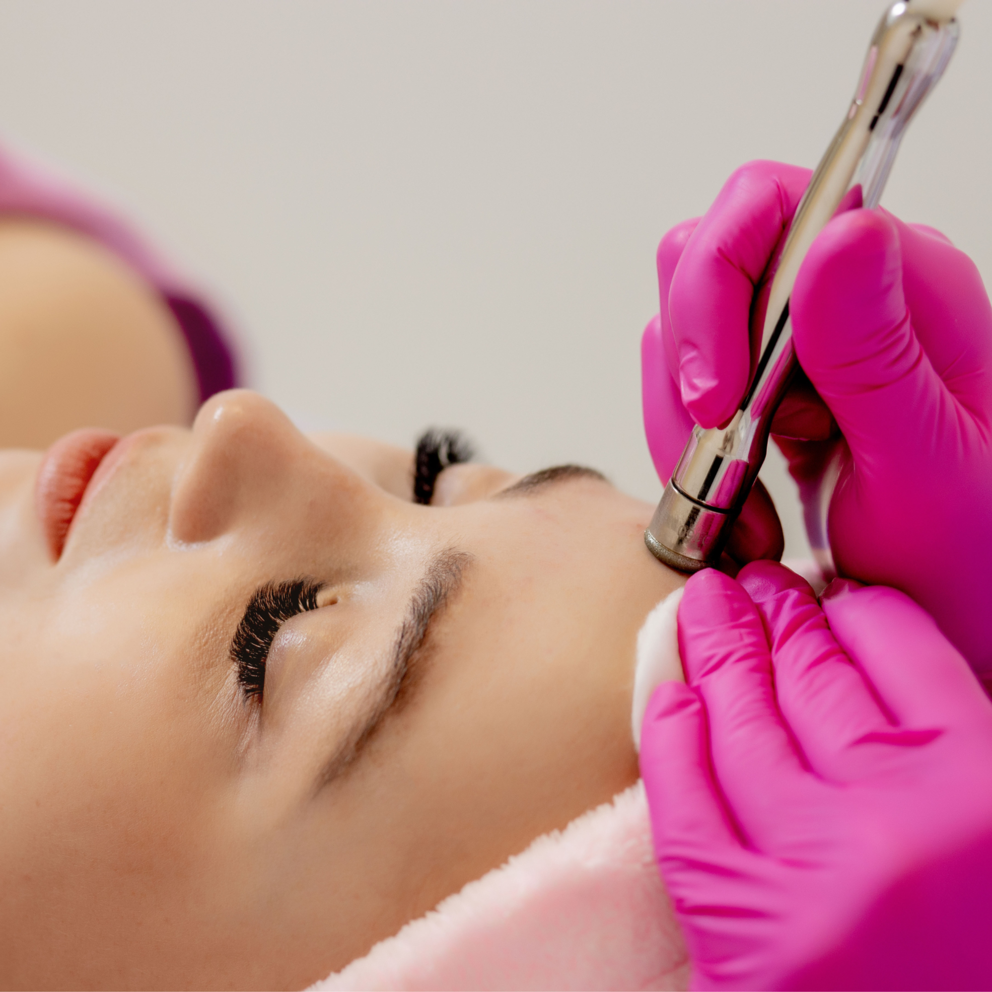 Krystal's Microderm Exfoliation