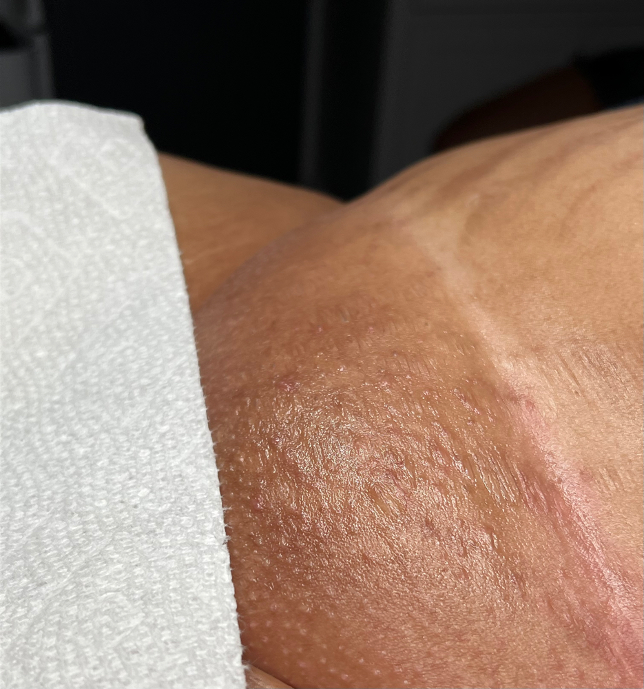 Brazilian Wax