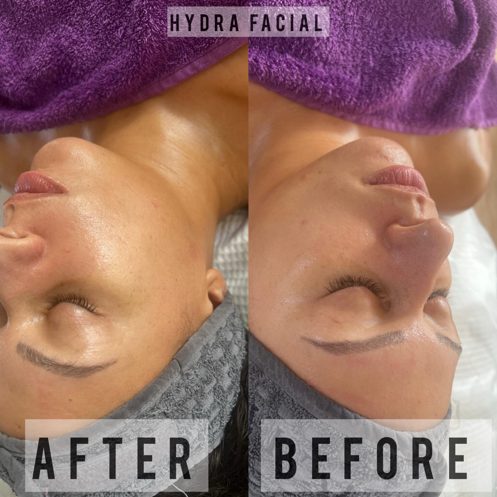 Bespoke Facial