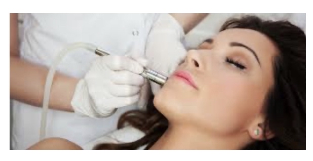 Microdermabrasion