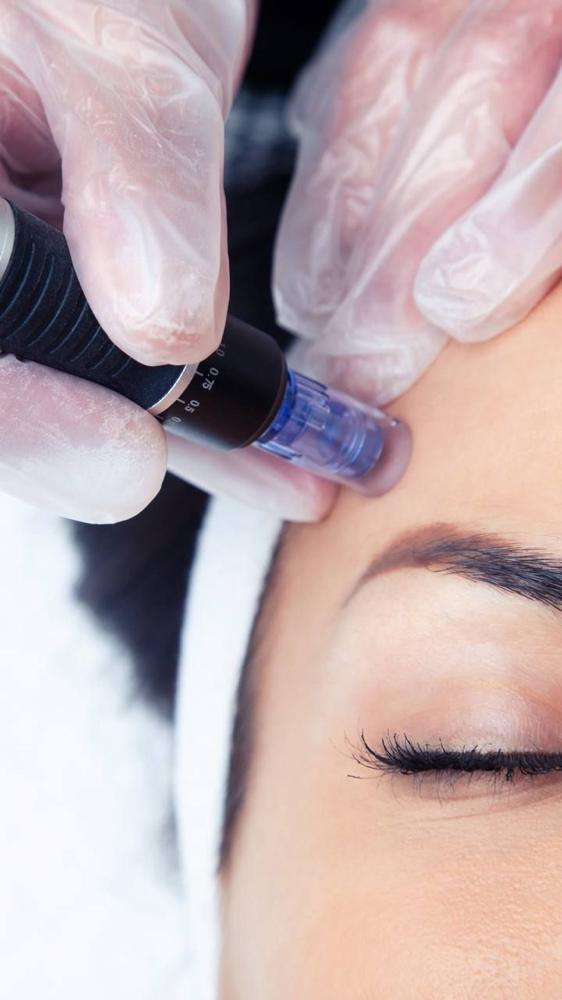 Nano-Infusion Treatment