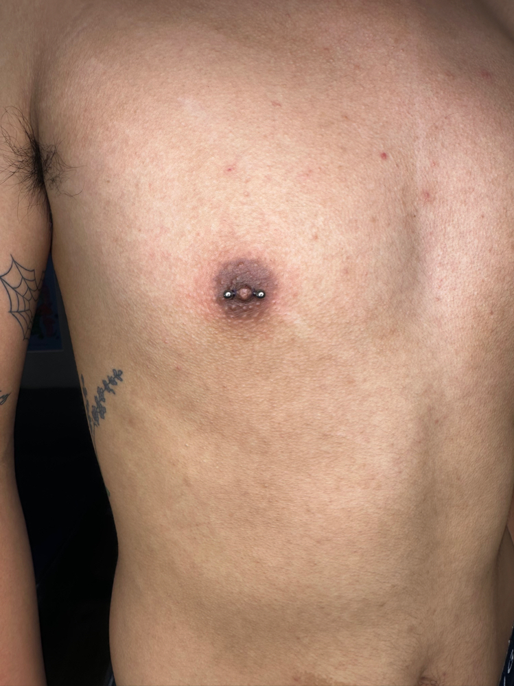 Nipple Piercing (1)