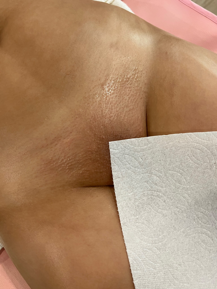 The Brazilian & Underarm Wax