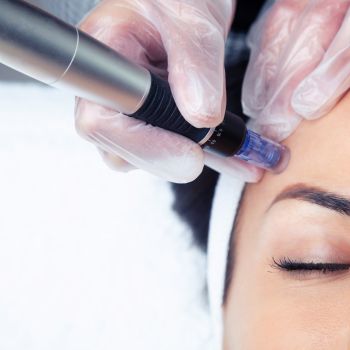 Five2 MicroNeedling w/Hydrinity HA