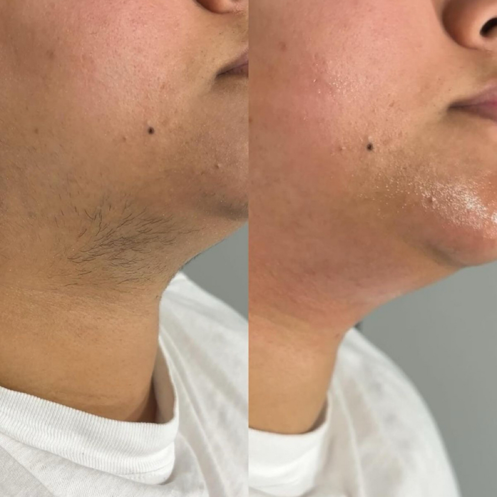 Chin Wax at Au Naturale Luxe in York, PA