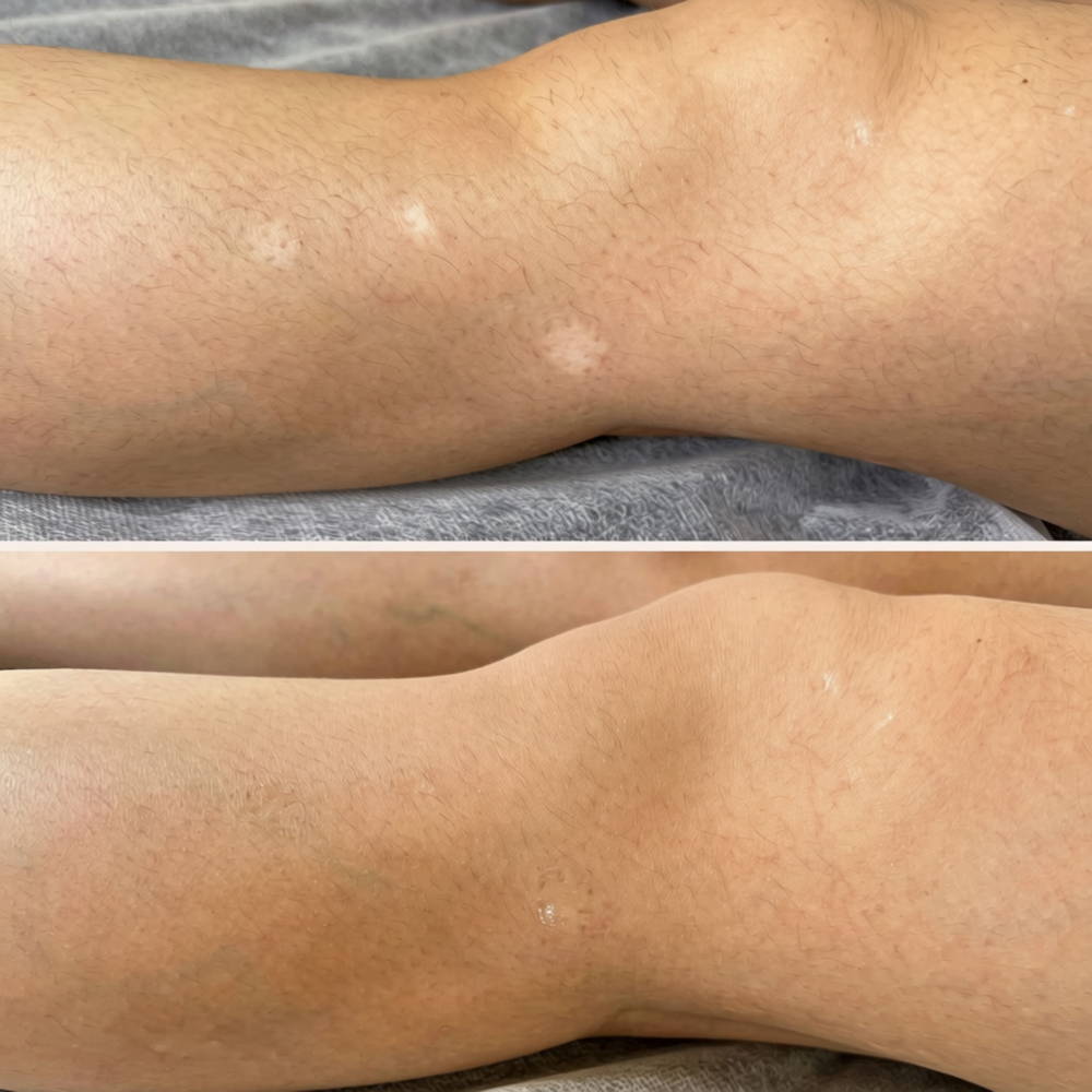 STRETCHMARK / SCAR CAMOUFLAGE 1:1 Training at BEAUTY LAB COLLECTIVE in Miami, FL
