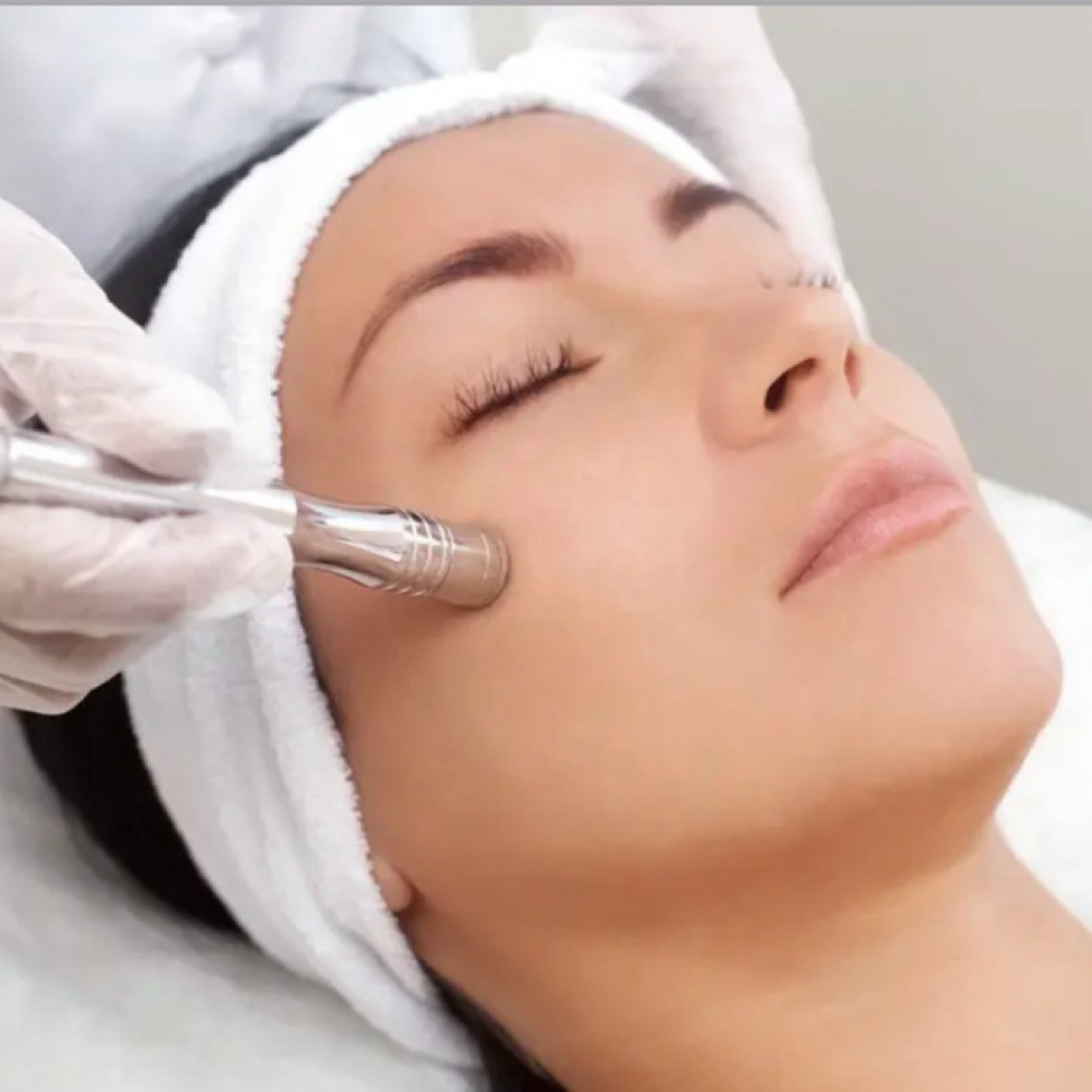 Microdermabrasion Facial at Desire Esthetics in Lodi, CA