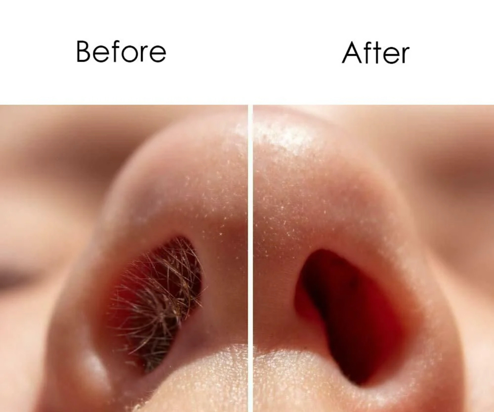 NOSE WAX